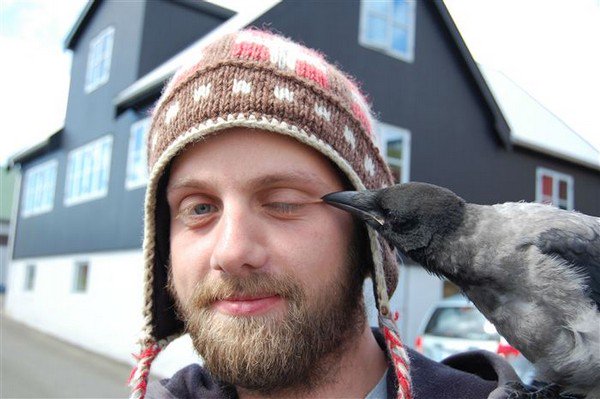 bird bite man eye